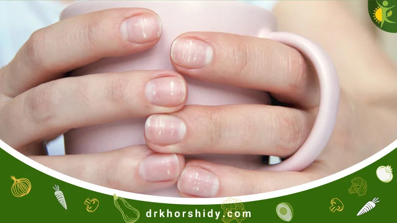 لکههای سفید روی ناخن